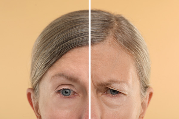 The image shows a person with an exaggeratedly large forehead compared to their face, highlighting the differences between the two areas for cosmetic or educational purposes.