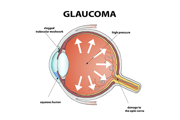 The image shows a diagrammatic illustration of an eye with various labeled parts, such as the pupil, iris, cornea, and eyelashes, along with arrows indicating the direction of light entering the eye and the path of vision through the eye to the brain.