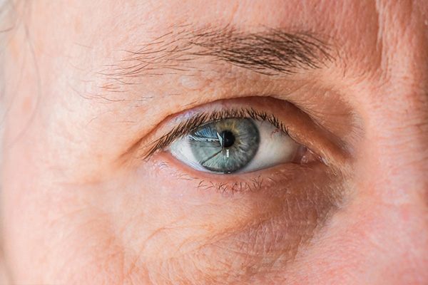 The image shows a close-up of an elderly person s eye with visible age spots and wrinkles around it, against a neutral background.