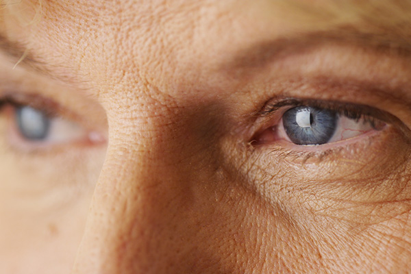 The image shows a close-up of an elderly person s face with prominent wrinkles, age spots, and blue eyes looking directly at the camera.